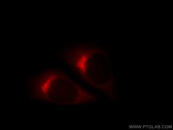 COPE Rabbit anti-Human, Polyclonal, Proteintech:Antibodies:Primary Antibodies