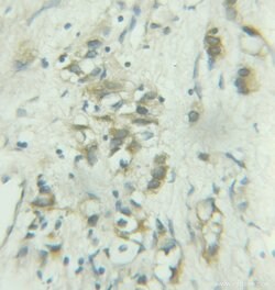 COPE Rabbit anti-Human, Polyclonal, Proteintech:Antibodies:Primary Antibodies