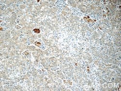 COPE Rabbit anti-Human, Polyclonal, Proteintech