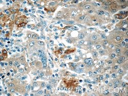 COPE Rabbit anti-Human, Polyclonal, Proteintech:Antibodies:Primary Antibodies