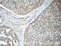 COPE Rabbit anti-Human, Polyclonal, Proteintech:Antibodies:Primary Antibodies