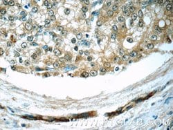 COPE Rabbit anti-Human, Polyclonal, Proteintech:Antibodies:Primary Antibodies