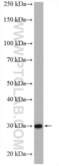 COPE Rabbit anti-Human, Polyclonal, Proteintech:Antibodies:Primary Antibodies