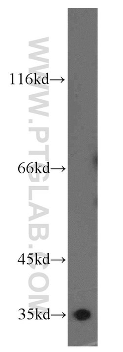 COPE Rabbit anti-Human, Polyclonal, Proteintech:Antibodies:Primary Antibodies