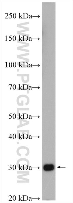 COPE Rabbit anti-Human, Polyclonal, Proteintech:Antibodies:Primary Antibodies