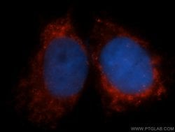 COX6A1 Rabbit anti-Human, Mouse, Rat, Polyclonal, Proteintech 150 &mu;L;