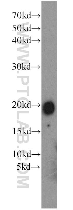 FXYD7 Rabbit anti-Human, Mouse, Rat, Polyclonal, Proteintech 150 &mu;L;