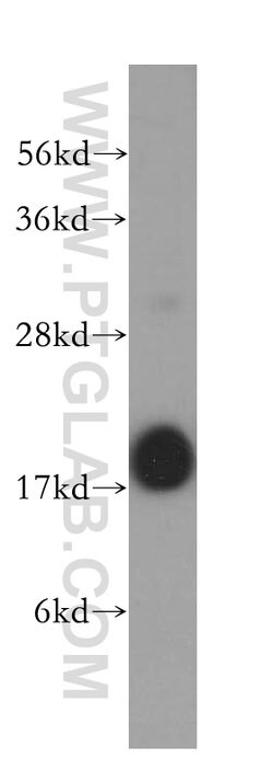 FXYD7 Rabbit anti-Human, Mouse, Rat, Polyclonal, Proteintech 150 &mu;L;