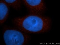 ADRM1 Rabbit anti-Human, Mouse, Rat, Polyclonal, Proteintech:Antibodies:Primary