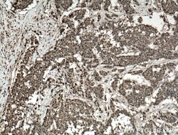 ADRM1 Rabbit anti-Human, Mouse, Rat, Polyclonal, Proteintech:Antibodies:Primary