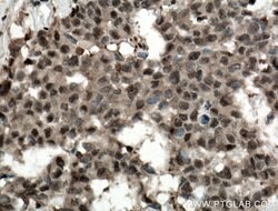 ADRM1 Rabbit anti-Human, Mouse, Rat, Polyclonal, Proteintech:Antibodies:Primary