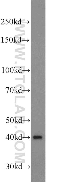 ADRM1 Rabbit anti-Human, Mouse, Rat, Polyclonal, Proteintech:Antibodies:Primary