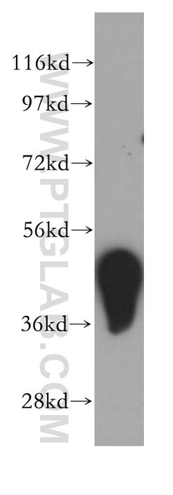 ADRM1 Rabbit anti-Human, Mouse, Rat, Polyclonal, Proteintech:Antibodies:Primary