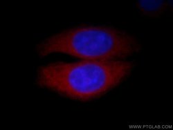 Calpain 2 Rabbit anti-Human, Mouse, Rat, Polyclonal, Proteintech 150 &mu;L;