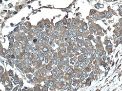 Calpain 2 Rabbit anti-Human, Mouse, Rat, Polyclonal, Proteintech 150 &mu;L;