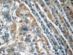 Calpain 2 Rabbit anti-Human, Mouse, Rat, Polyclonal, Proteintech 150 &mu;L;
