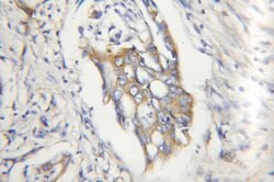 Calpain 2 Rabbit anti-Human, Mouse, Rat, Polyclonal, Proteintech 150 &mu;L;
