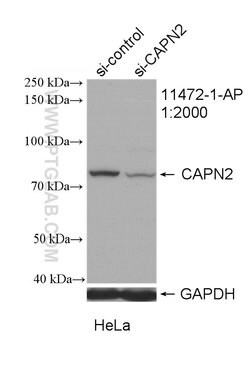 Calpain 2 Rabbit anti-Human, Mouse, Rat, Polyclonal, Proteintech 150 &mu;L;