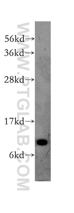 TIMM9 Rabbit anti-Human, Mouse, Rat, Polyclonal, Proteintech 150 &mu;L;