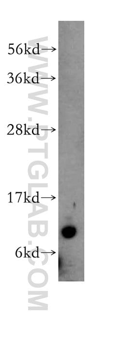 TIMM9 Rabbit anti-Human, Mouse, Rat, Polyclonal, Proteintech 150 &mu;L;