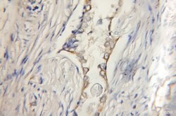 AGS3 Rabbit anti-Human, Mouse, Rat, Polyclonal, Proteintech:Antibodies:Primary