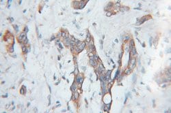 SCMH1 Rabbit anti-Human, Mouse, Rat, Polyclonal, Proteintech:Antibodies:Primary