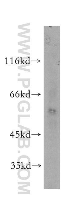 SCMH1 Rabbit anti-Human, Mouse, Rat, Polyclonal, Proteintech:Antibodies:Primary