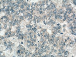 Apelin Rabbit anti-Human, Mouse, Rat, Polyclonal, Proteintech:Antibodies:Primary
