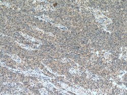 FBXW2 Rabbit anti-Human, Mouse, Rat, Polyclonal, Proteintech:Antibodies:Primary