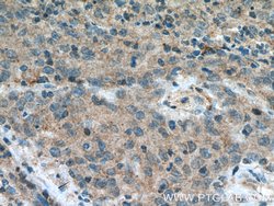 FBXW2 Rabbit anti-Human, Mouse, Rat, Polyclonal, Proteintech:Antibodies:Primary