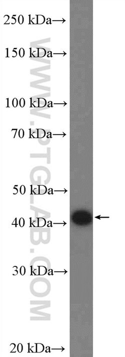 FBXW2 Rabbit anti-Human, Mouse, Rat, Polyclonal, Proteintech:Antibodies:Primary