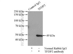 TFDP2 Rabbit anti-Human, Mouse, Rat, Polyclonal, Proteintech 20 &mu;L;