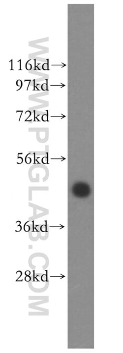 TFDP2 Rabbit anti-Human, Mouse, Rat, Polyclonal, Proteintech 20 &mu;L;
