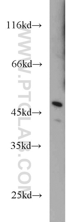 TFDP2 Rabbit anti-Human, Mouse, Rat, Polyclonal, Proteintech 20 &mu;L;