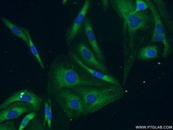 BubR1 Rabbit anti-Human, Mouse, Polyclonal, Proteintech 150 &mu;L; Unconjugated:Antibodies,