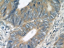 BubR1 Rabbit anti-Human, Mouse, Polyclonal, Proteintech 150 &mu;L; Unconjugated:Antibodies,