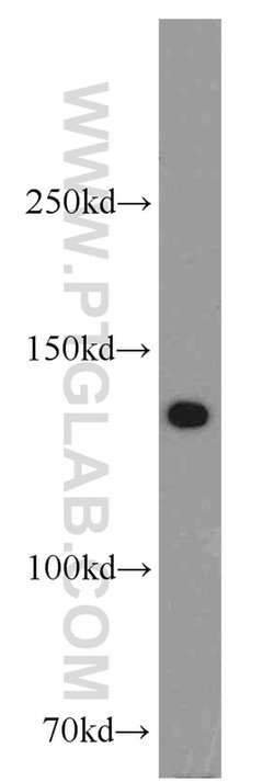 BubR1 Rabbit anti-Human, Mouse, Polyclonal, Proteintech 150 &mu;L; Unconjugated:Antibodies,