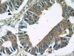 BubR1 Rabbit anti-Human, Mouse, Polyclonal, Proteintech 150 &mu;L; Unconjugated:Antibodies,