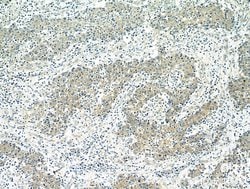 BubR1 Rabbit anti-Human, Mouse, Polyclonal, Proteintech 150 &mu;L; Unconjugated:Antibodies,
