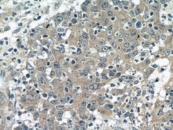 BubR1 Rabbit anti-Human, Mouse, Polyclonal, Proteintech 150 &mu;L; Unconjugated:Antibodies,