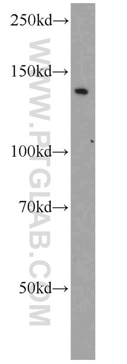 BubR1 Rabbit anti-Human, Mouse, Polyclonal, Proteintech 150 &mu;L; Unconjugated:Antibodies,