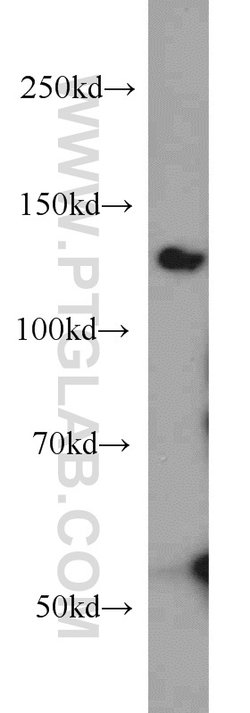 BubR1 Rabbit anti-Human, Mouse, Polyclonal, Proteintech 150 &mu;L; Unconjugated:Antibodies,