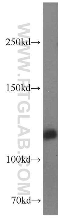 BubR1 Rabbit anti-Human, Mouse, Polyclonal, Proteintech 150 &mu;L; Unconjugated:Antibodies,