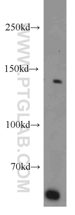 BubR1 Rabbit anti-Human, Mouse, Polyclonal, Proteintech 150 &mu;L; Unconjugated:Antibodies,