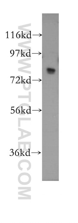 MED17 Rabbit anti-Human, Mouse, Rat, Polyclonal, Proteintech 150 &mu;L;