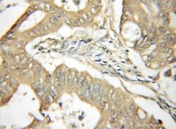 YME1L1 Rabbit anti-Human, Mouse, Rat, Polyclonal, Proteintech:Antibodies:Primary