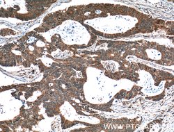 YME1L1 Rabbit anti-Human, Mouse, Rat, Polyclonal, Proteintech:Antibodies:Primary