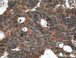 YME1L1 Rabbit anti-Human, Mouse, Rat, Polyclonal, Proteintech:Antibodies:Primary