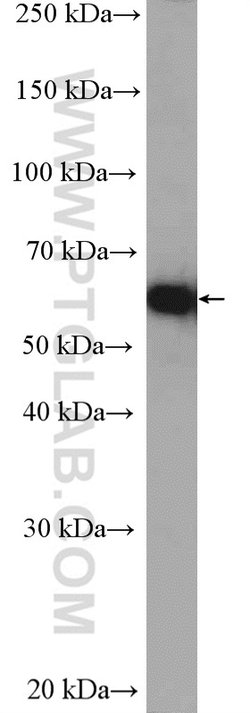 YME1L1 Rabbit anti-Human, Mouse, Rat, Polyclonal, Proteintech:Antibodies:Primary
