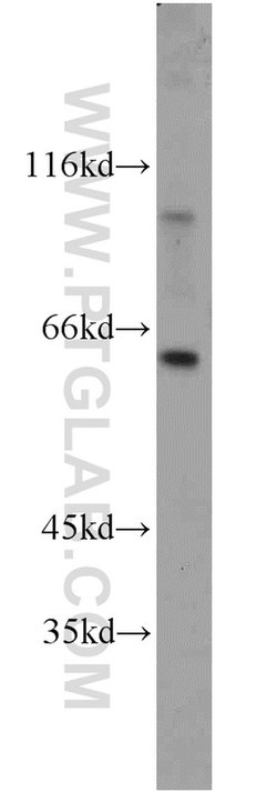 YME1L1 Rabbit anti-Human, Mouse, Rat, Polyclonal, Proteintech:Antibodies:Primary